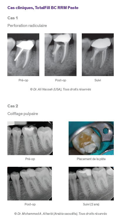 Totalfill RRM Paste 2